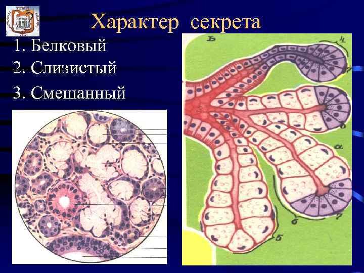 Характер секрета 1. Белковый 2. Слизистый 3. Смешанный 