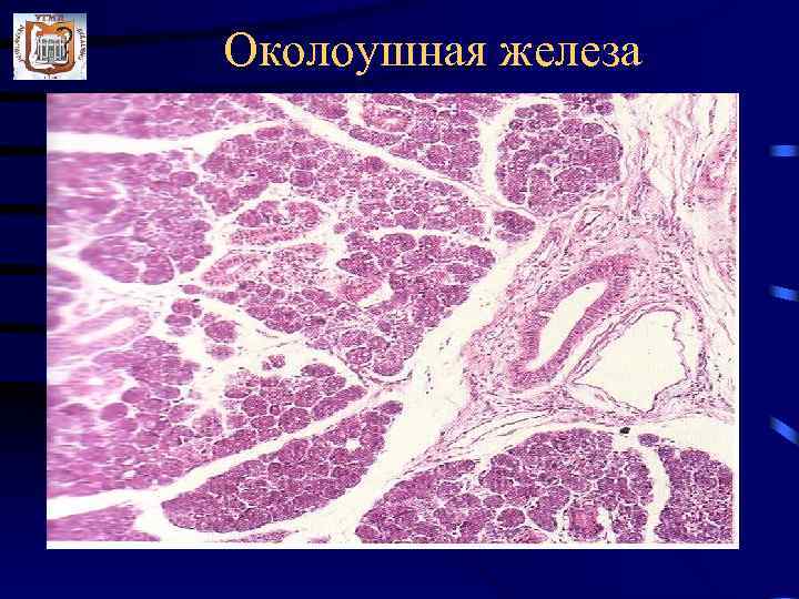 Околоушная железа. Околоушная железа гистология препарат. Околоушная слюнная железа гистология. Околоушная слюнная железа препарат. Срез околоушной железы гистология.