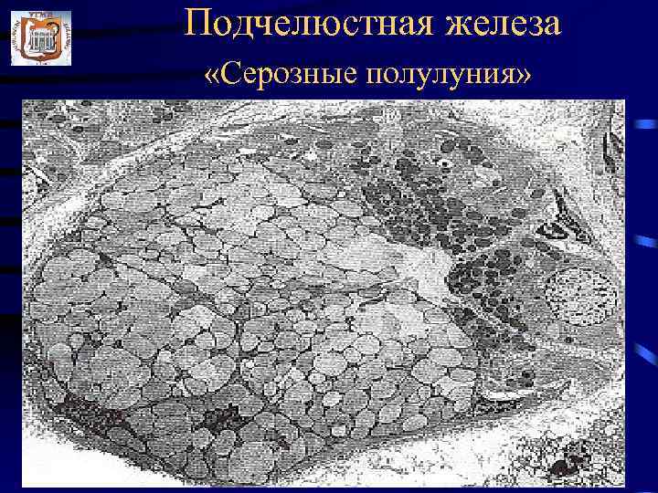 Подчелюстная железа «Серозные полулуния» 
