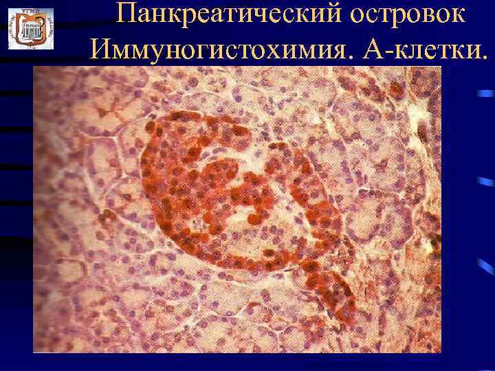 Панкреатический островок Иммуногистохимия. А-клетки. 