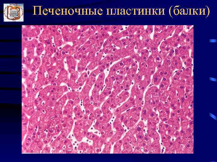 Печеночные пластинки (балки) 
