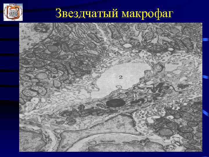 Звездчатый макрофаг 