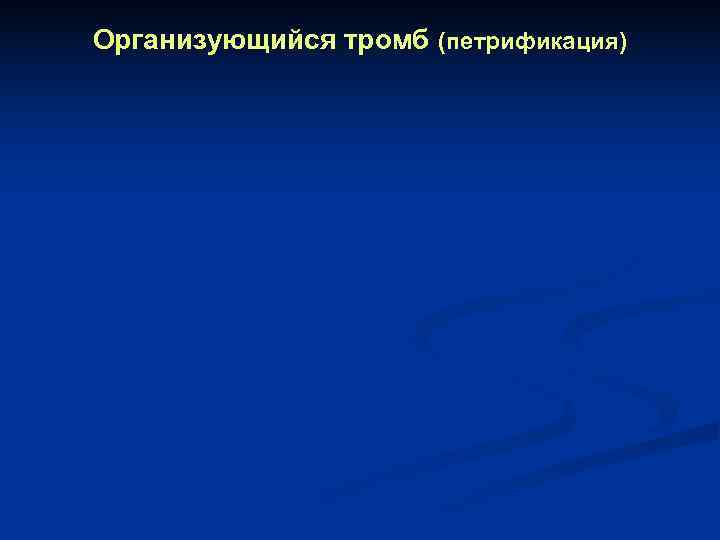 Организующийся тромб (петрификация) 