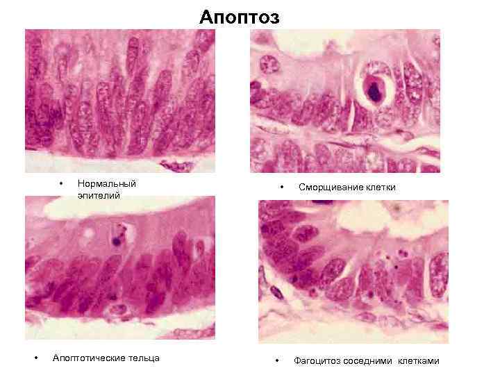       Апоптоз  •  Нормальный   
