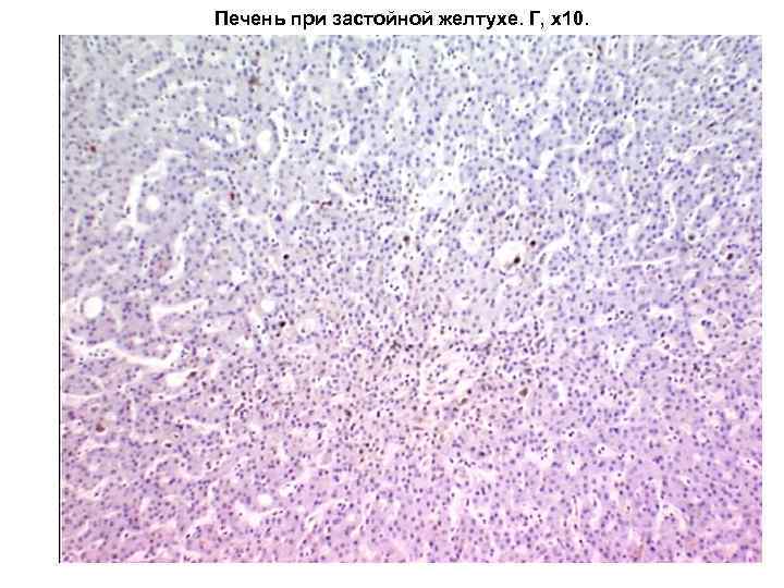 Печень при застойной желтухе. Г, х10. 