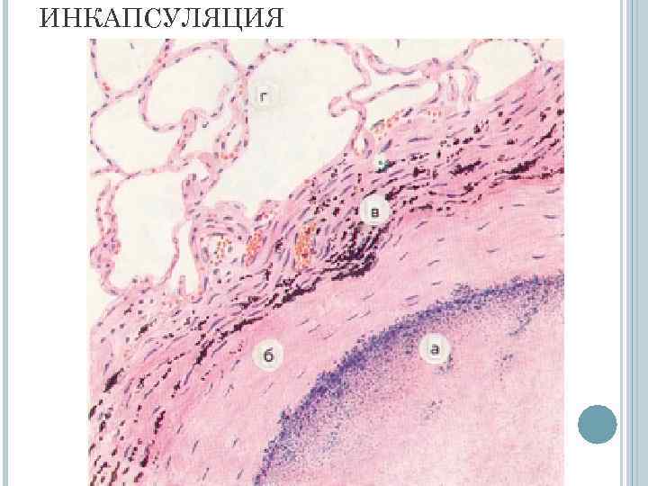 ИНКАПСУЛЯЦИЯ 