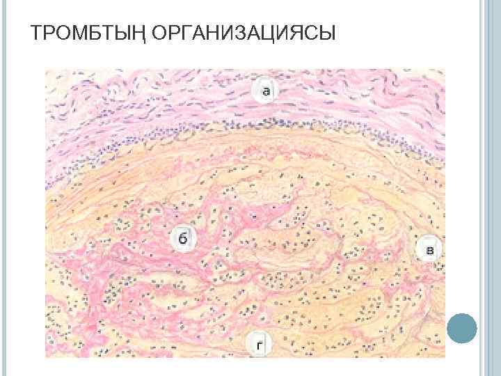 ТРОМБТЫҢ ОРГАНИЗАЦИЯСЫ 