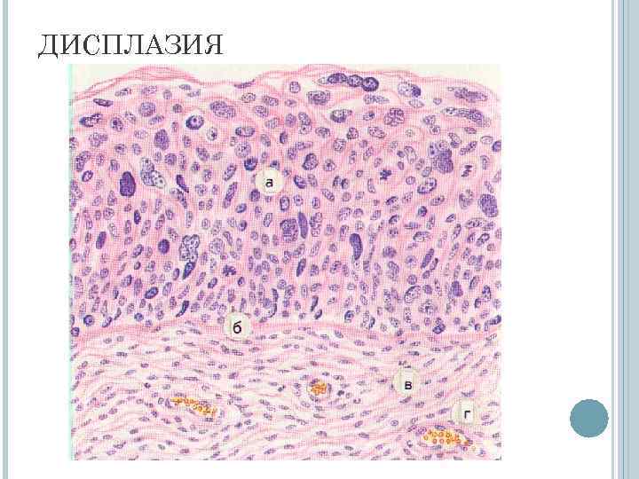 ДИСПЛАЗИЯ 