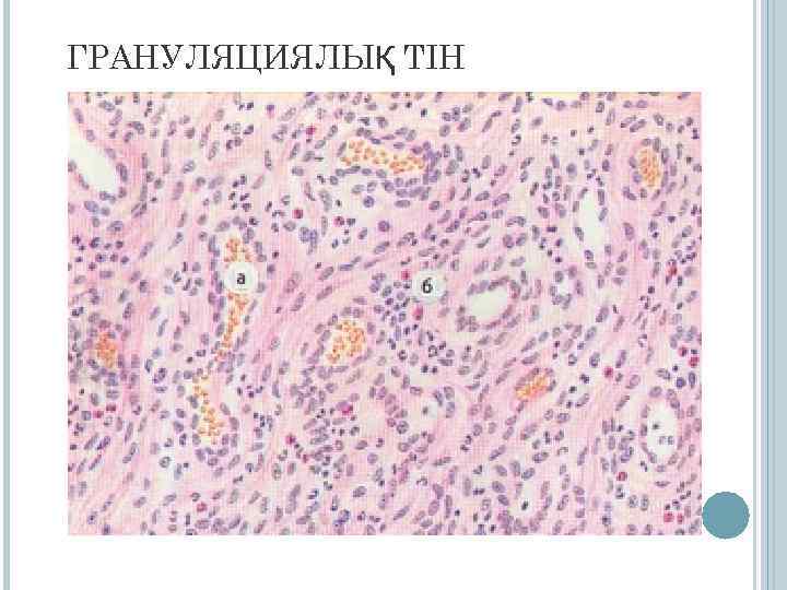 ГРАНУЛЯЦИЯЛЫҚ ТІН 