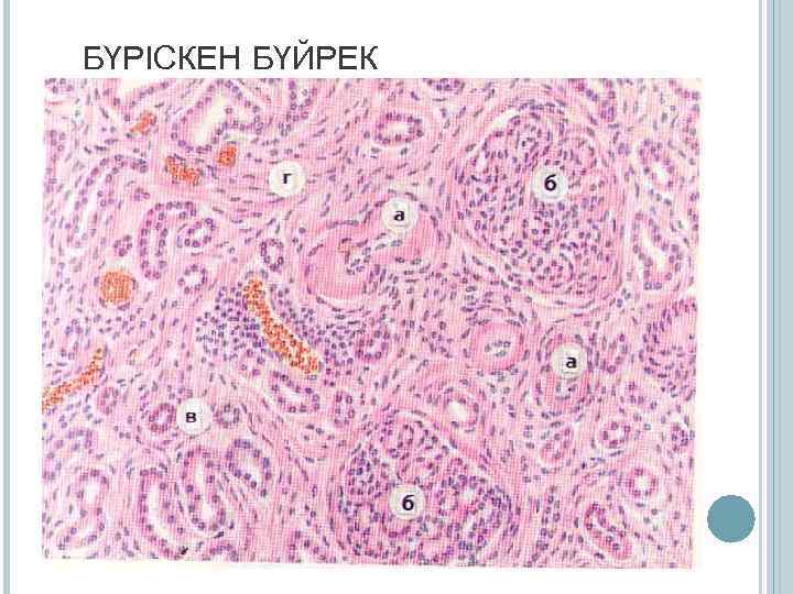 БҮРІСКЕН БҮЙРЕК 