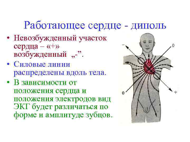 Работающее сердце - диполь • Невозбужденный участок сердца – «+» возбужденный „-”. • Силовые