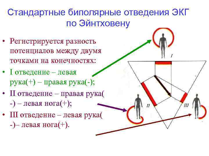 Стандартные биполярные отведения ЭКГ по Эйнтховену • Регистрируется разность потенциалов между двумя точками на