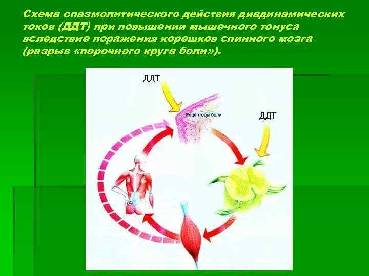 Схема спазмолитического действия диадинамических токов (ДДТ) при повышении мышечного тонуса вследствие поражения корешков спинного