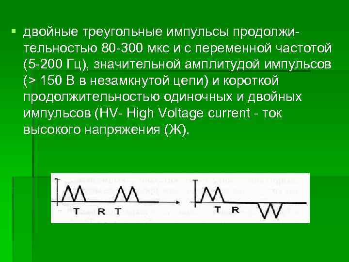 § двойные треугольные импульсы продолжи тельностью 80 300 мкс и с переменной частотой (5