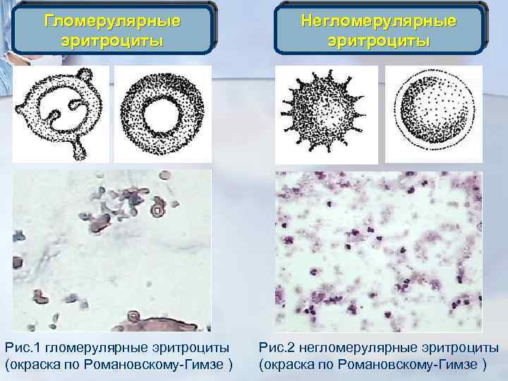 В проведенном опыте результаты которого изображены на рисунке эритроциты поместили