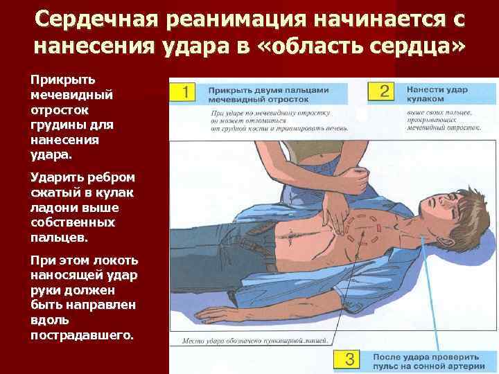 Сердечная реанимация начинается с нанесения удара в «область сердца» Прикрыть мечевидный отросток грудины для