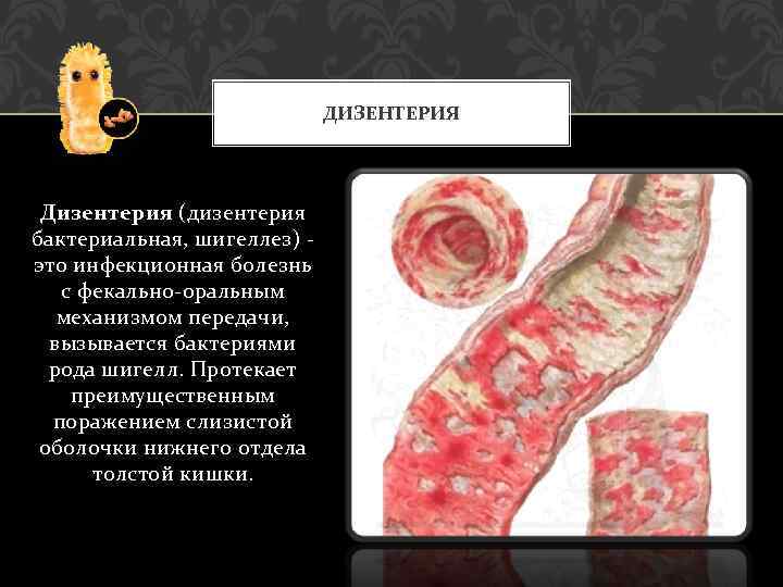 ДИЗЕНТЕРИЯ Дизентерия (дизентерия бактериальная, шигеллез) - это инфекционная болезнь с фекально-оральным механизмом передачи, вызывается