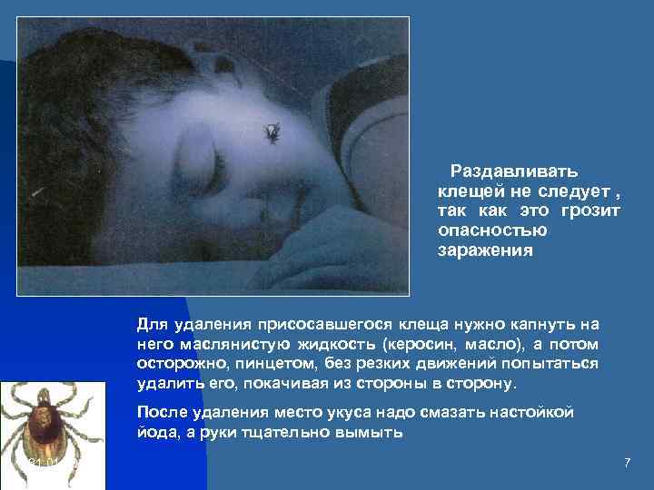 Раздавливать клещей не следует , так как это грозит опасностью заражения Для удаления присосавшегося