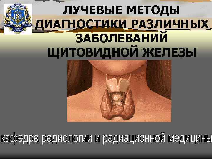 ЛУЧЕВЫЕ МЕТОДЫ ДИАГНОСТИКИ РАЗЛИЧНЫХ ЗАБОЛЕВАНИЙ ЩИТОВИДНОЙ ЖЕЛЕЗЫ 