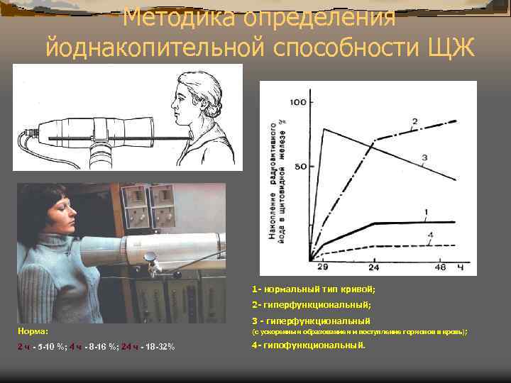 Методика определения йоднакопительной способности ЩЖ 1 - нормальный тип кривой; 2 - гиперфункциональный; 3