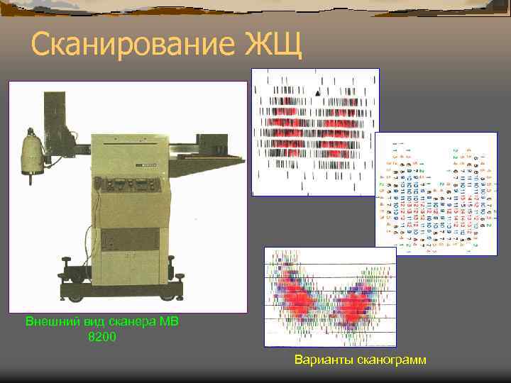 Сканирование ЖЩ Внешний вид сканера МВ 8200 Варианты сканограмм 