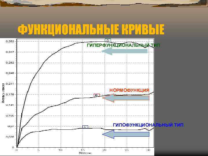ФУНКЦИОНАЛЬНЫЕ КРИВЫЕ ГИПЕРФУНКЦИОНАЛЬНЫЙ ТИП НОРМОФУНКЦИЯ ГИПОФУНКЦИОНАЛЬНЫЙ ТИП 