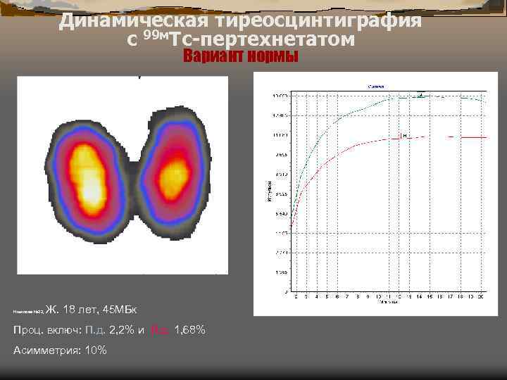 Динамическая тиреосцинтиграфия с 99 м. Тс-пертехнетатом Вариант нормы Николова № 22, Ж. 18 лет,
