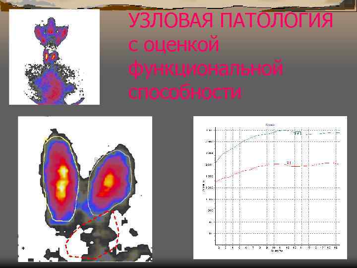 УЗЛОВАЯ ПАТОЛОГИЯ с оценкой функциональной способности 