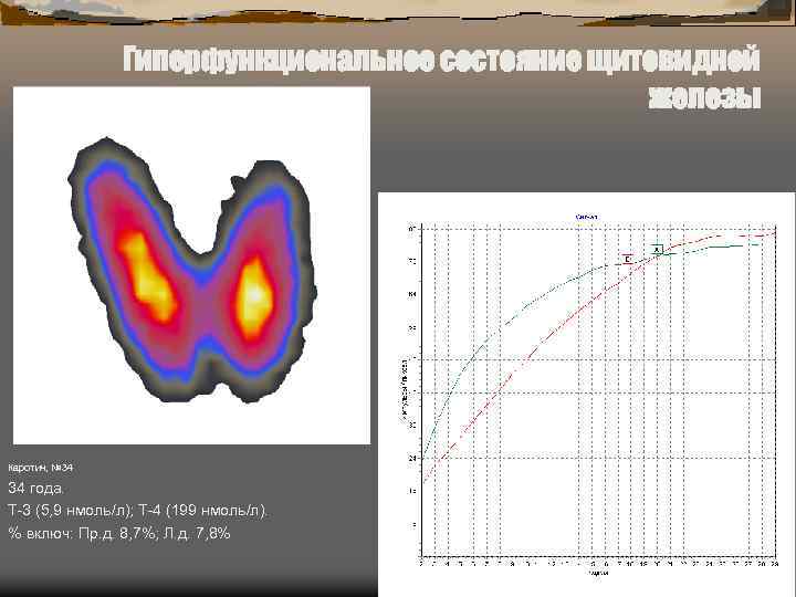 Гиперфункциональное состояние щитовидной железы Каротич, № 34 34 года. Т-3 (5, 9 нмоль/л); Т-4