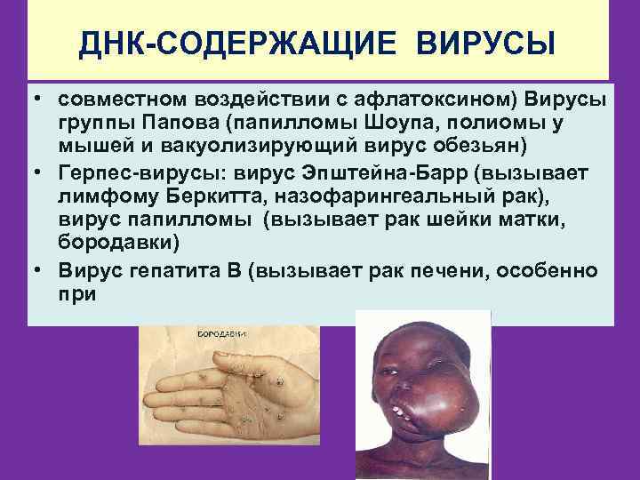 ДНК-СОДЕРЖАЩИЕ ВИРУСЫ • совместном воздействии с афлатоксином) Вирусы группы Папова (папилломы Шоупа, полиомы у