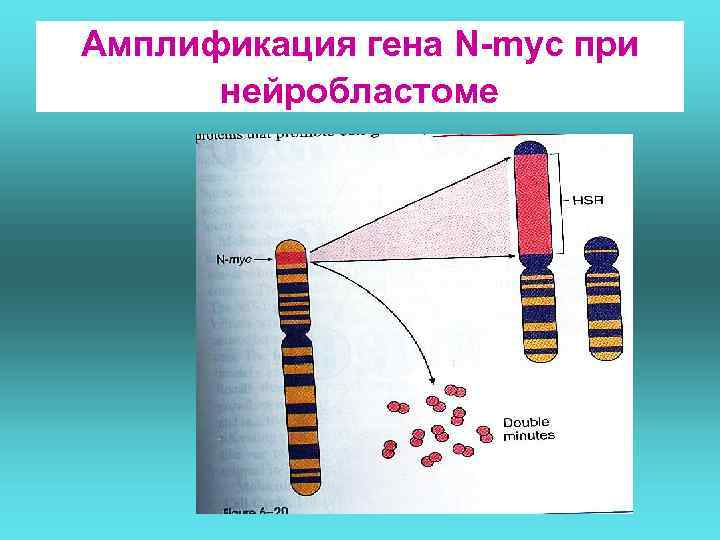 Амплификация гена N-myc при нейробластоме 