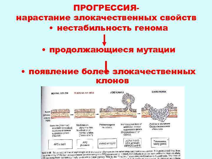 ПРОГРЕССИЯнарастание злокачественных свойств • нестабильность генома • продолжающиеся мутации • появление более злокачественных клонов