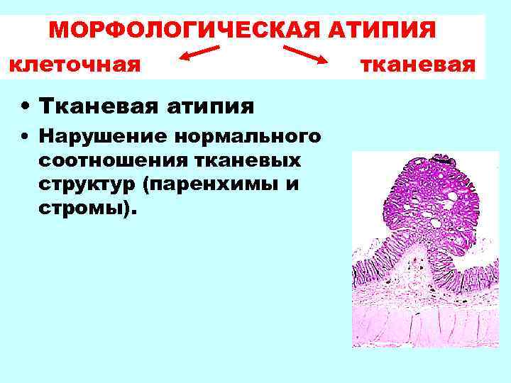 Атипия что это. Тканевая и клеточная атипия. Признаки тканевой атипии. Клеточная атипия.