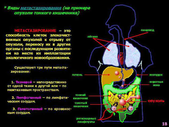 * Виды метастазирования (на примере опухоли тонкого кишечника) МЕТАСТАЗИРОВАНИЕ – это способность клеток злокачественных