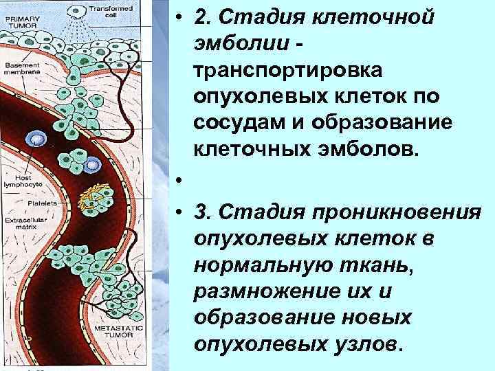  • 2. Стадия клеточной эмболии транспортировка опухолевых клеток по сосудам и образование клеточных