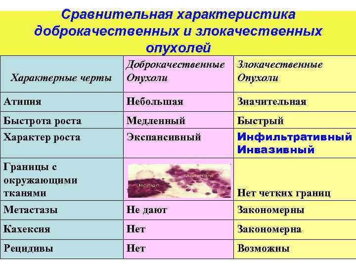 Сравнительная характеристика доброкачественных и злокачественных опухолей Доброкачественные Опухоли Злокачественные Опухоли Атипия Небольшая Значительная Быстрота