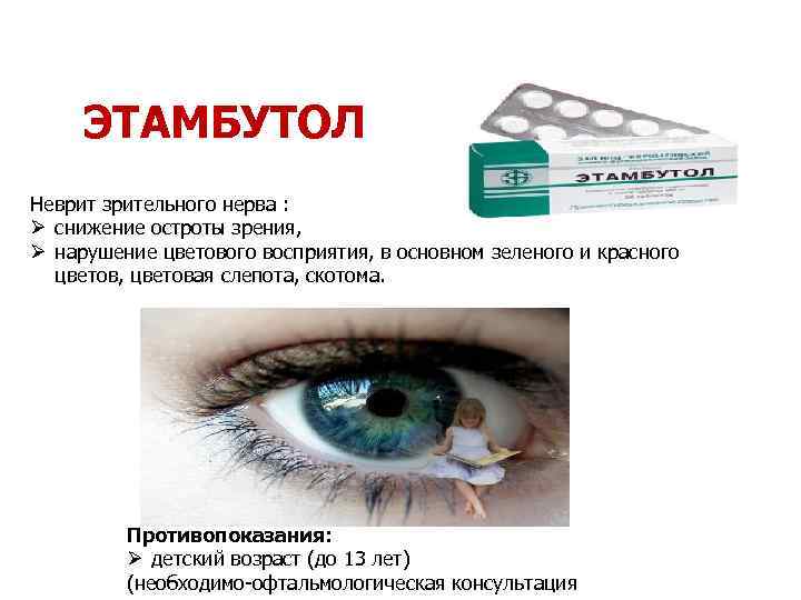 ЭТАМБУТОЛ Неврит зрительного нерва : Ø снижение остроты зрения, Ø нарушение цветового восприятия, в