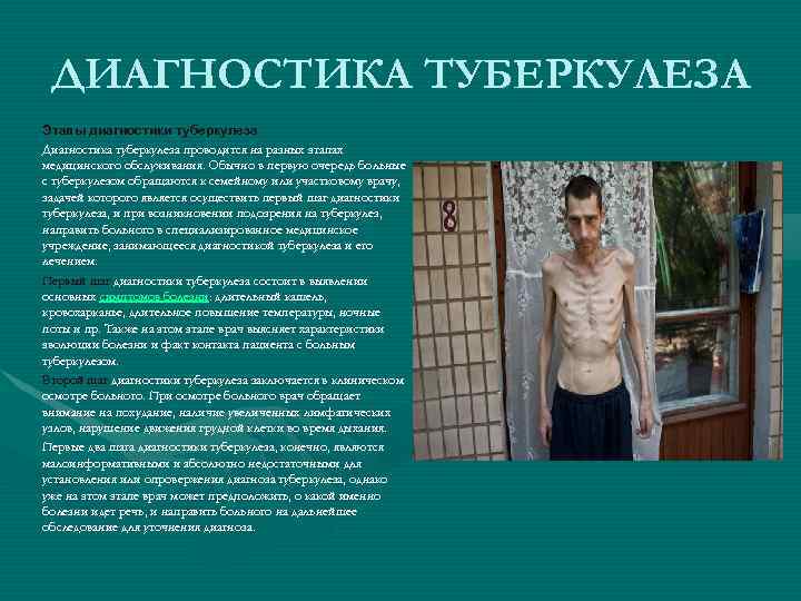 ДИАГНОСТИКА ТУБЕРКУЛЕЗА Этапы диагностики туберкулеза Диагностика туберкулеза проводится на разных этапах медицинского обслуживания. Обычно