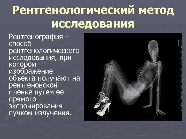 Рентгенологический метод исследования Рентгенография – способ рентгенологического исследования, при котором изображение объекта получают на