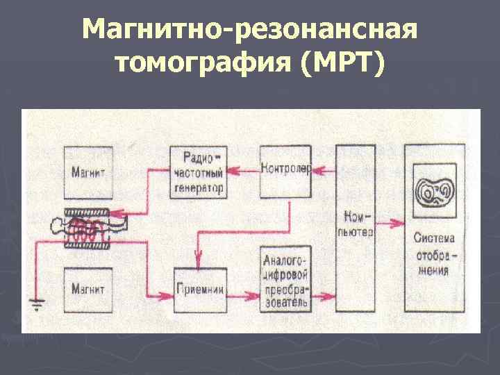 Магнитно резонансная томография (МРТ) 