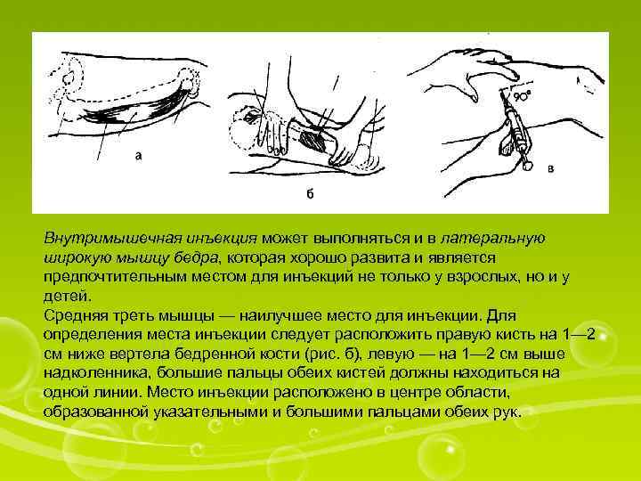 Внутримышечная инъекция может выполняться и в латеральную широкую мышцу бедра, которая хорошо развита и