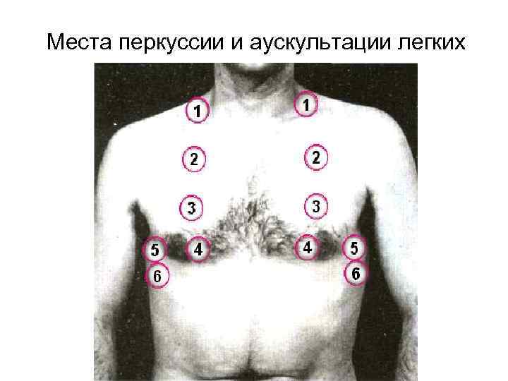 Места перкуссии и аускультации легких 