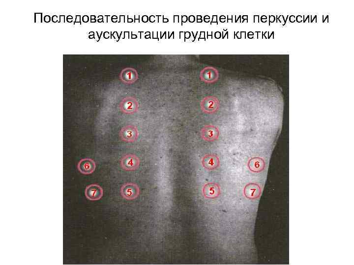 Последовательность проведения перкуссии и аускультации грудной клетки 