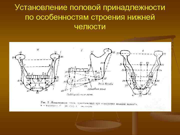 Установление половой принадлежности по особенностям строения нижней челюсти 