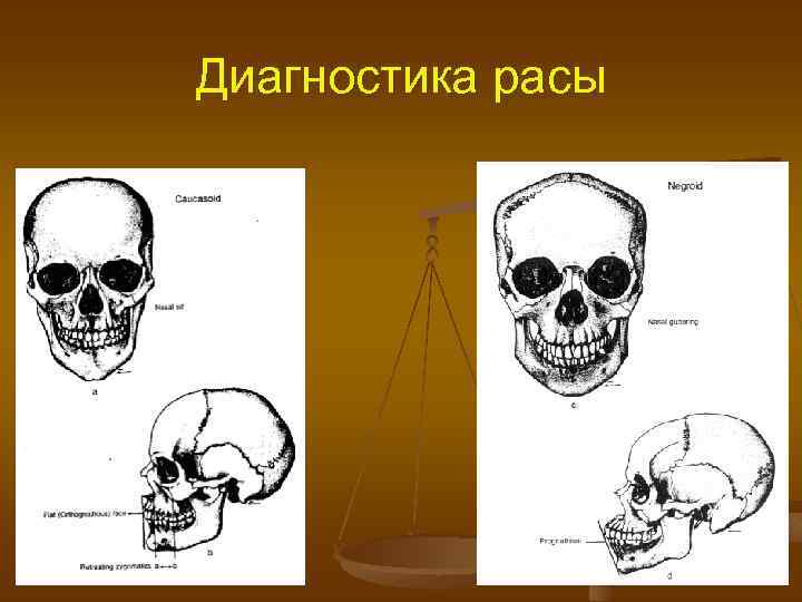 Диагностика расы 