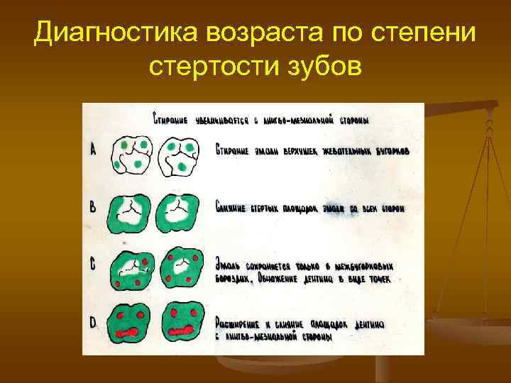 Диагностика возраста по степени стертости зубов 