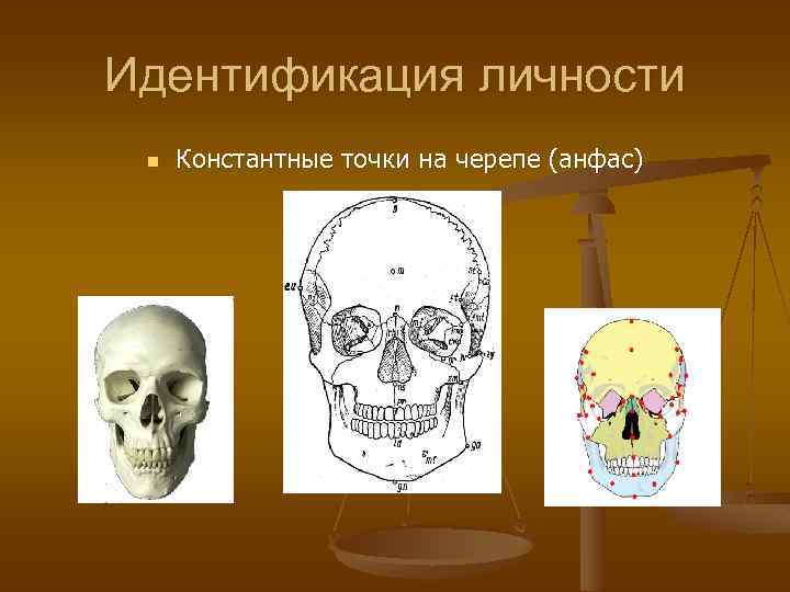 Идентификация личности. Константные точки черепа для идентификации. Виды отождествления личности. Как проходит идентификация личности.