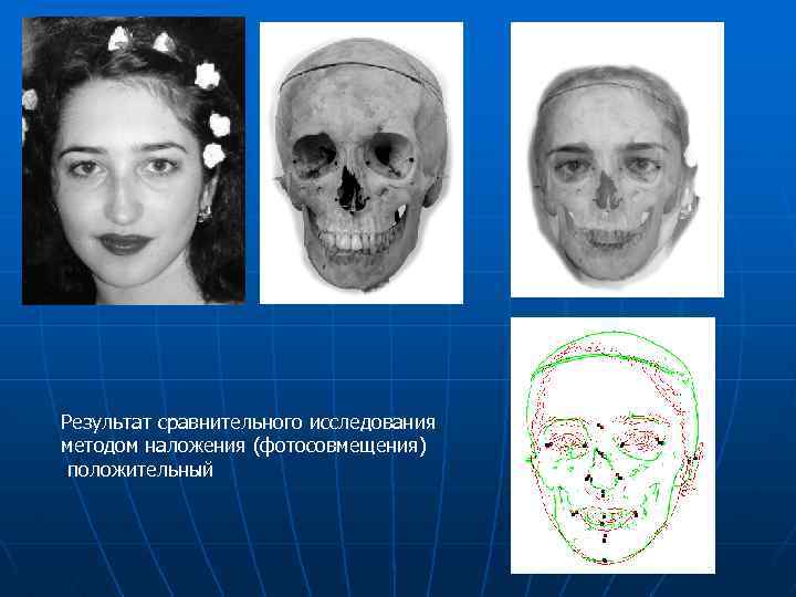 Результат сравнительного исследования методом наложения (фотосовмещения) положительный 