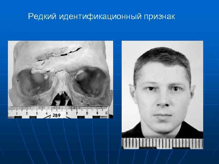 Редкий идентификационный признак 