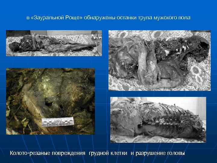 в «Зауральной Роще» обнаружены останки трупа мужского пола Колото-резаные повреждения грудной клетки и разрушение